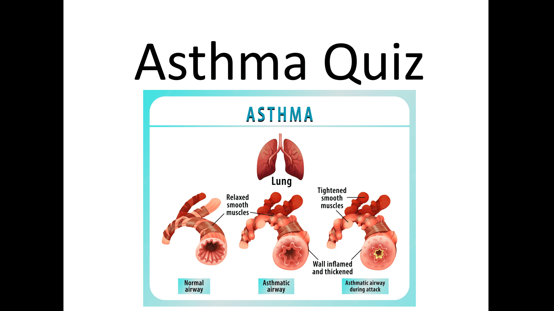 Asthma Quiz - Ms.Thu Medical English